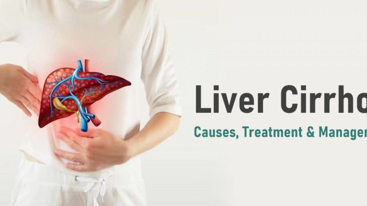 Cirrhosis of the Liver