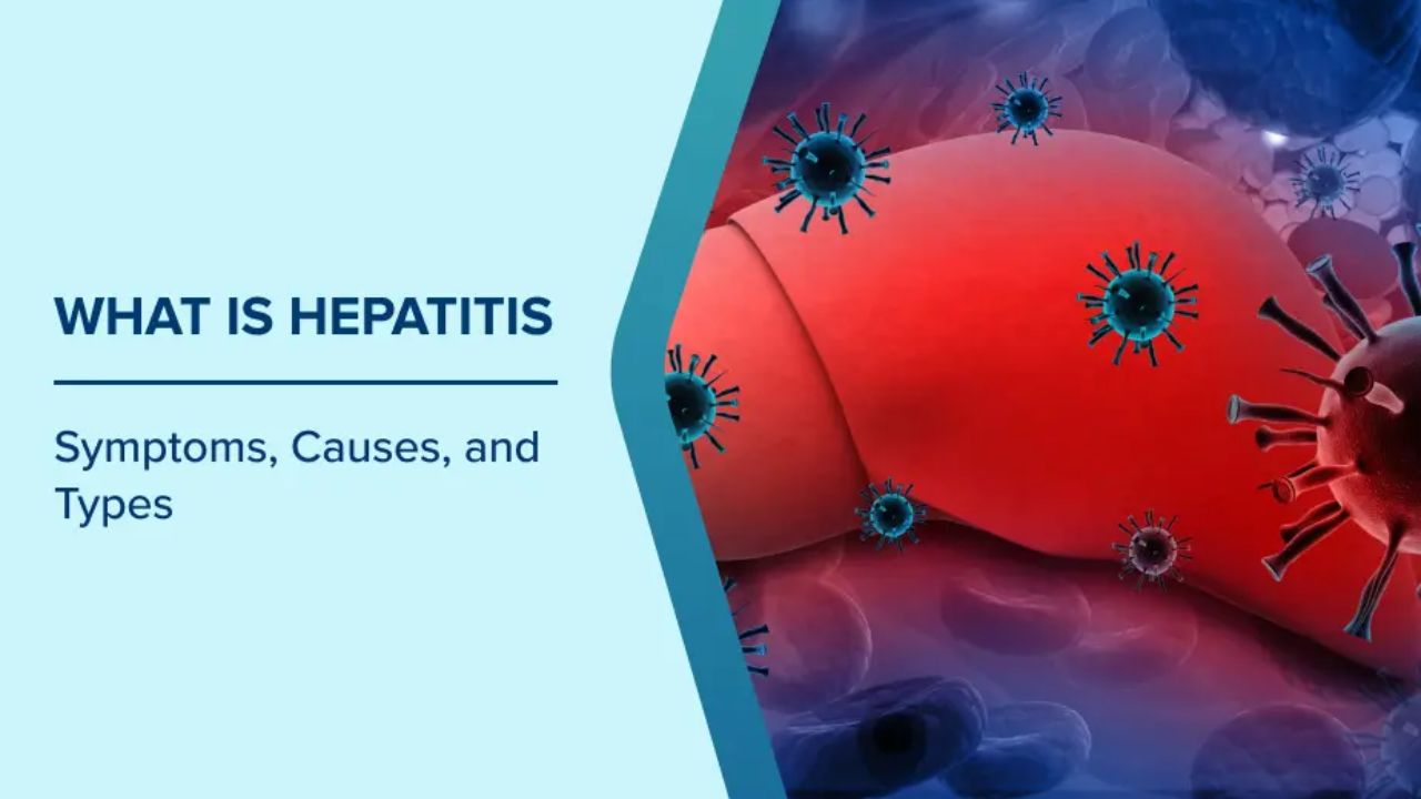 Hepatitis A, B, and C